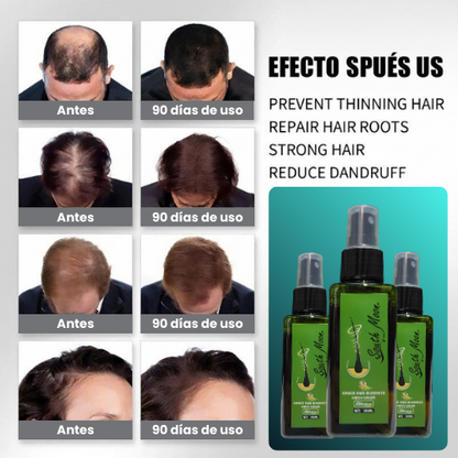 [Compra 1, Lleva 3] Serum GreenMoon – Cabello Fuerte, Raíces Sanas, Sin Caspa - Tónico Capilar 90 Días