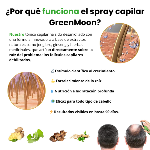[Compra 1, Lleva 3] Serum GreenMoon – Cabello Fuerte, Raíces Sanas, Sin Caspa - Tónico Capilar 90 Días